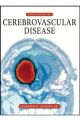 PRINCIPLES OF CEREBROVASCULAR DISEASE