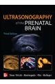 Ultrasonography of the PreNatal Brain (3rd Edition)