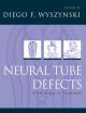 Neural Tube Defects From Origin to Treatment