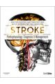 Stroke: Pathophysiology, Diagnosis, and