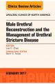 Male Urethral Reconstruction & the Mgmt