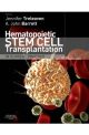 HEMATOPOEITIC STEM CELL TRANSPLANTATION