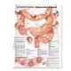 Understanding Colorectal Cancer Anatomical Chart