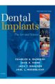 Dental Implants: The Art and S