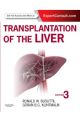 Transplantation of the Liver 3e