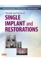 Principles Practice Single Implant 1e