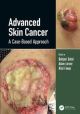 Advanced Skin Cancer - A Case-Based Approach