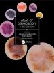 Atlas of Dermoscopy, 3rd Edit