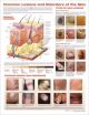 Common Lesions and Disorders of the Skin Anatomical Chart Laminated - 3rd Edit